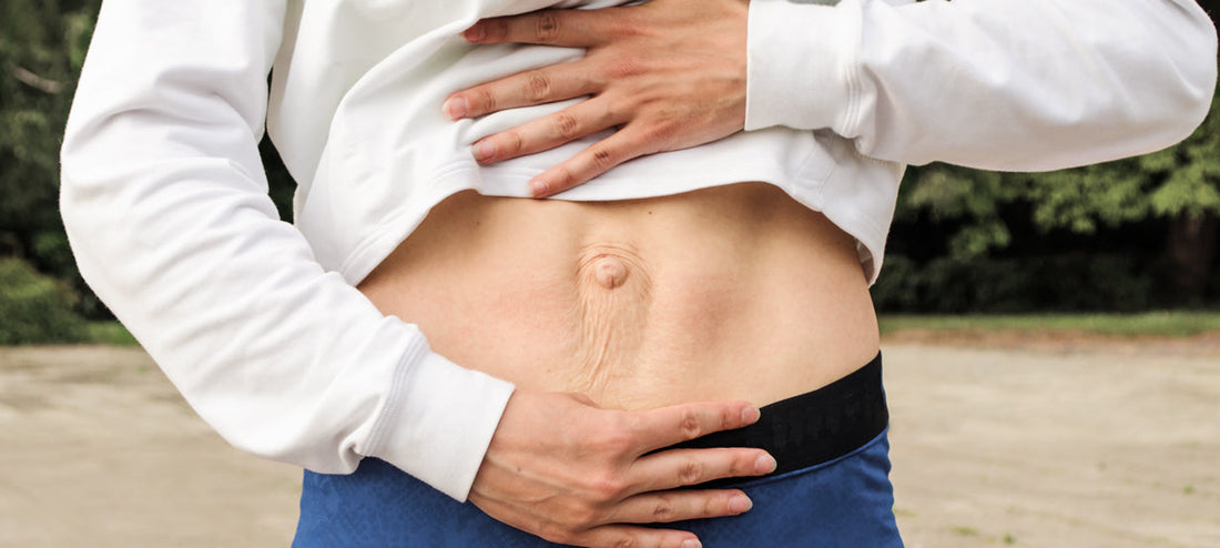 Woman shows her abdomen with a diastasis recti