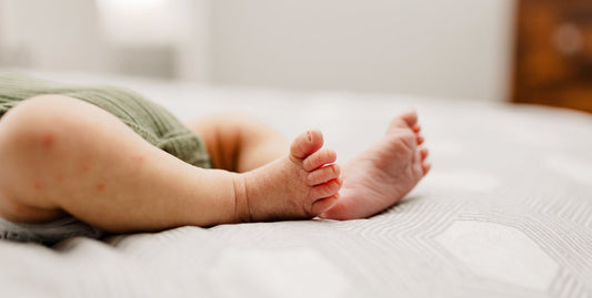 The heat buttons: causes, symptoms, and treatments