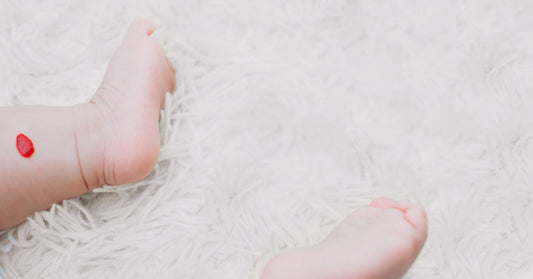 Baby with a hemangioma on the leg