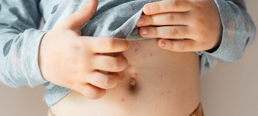 The most common childhood diseases: Chickenpox