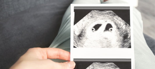 ultrasound showing twins
